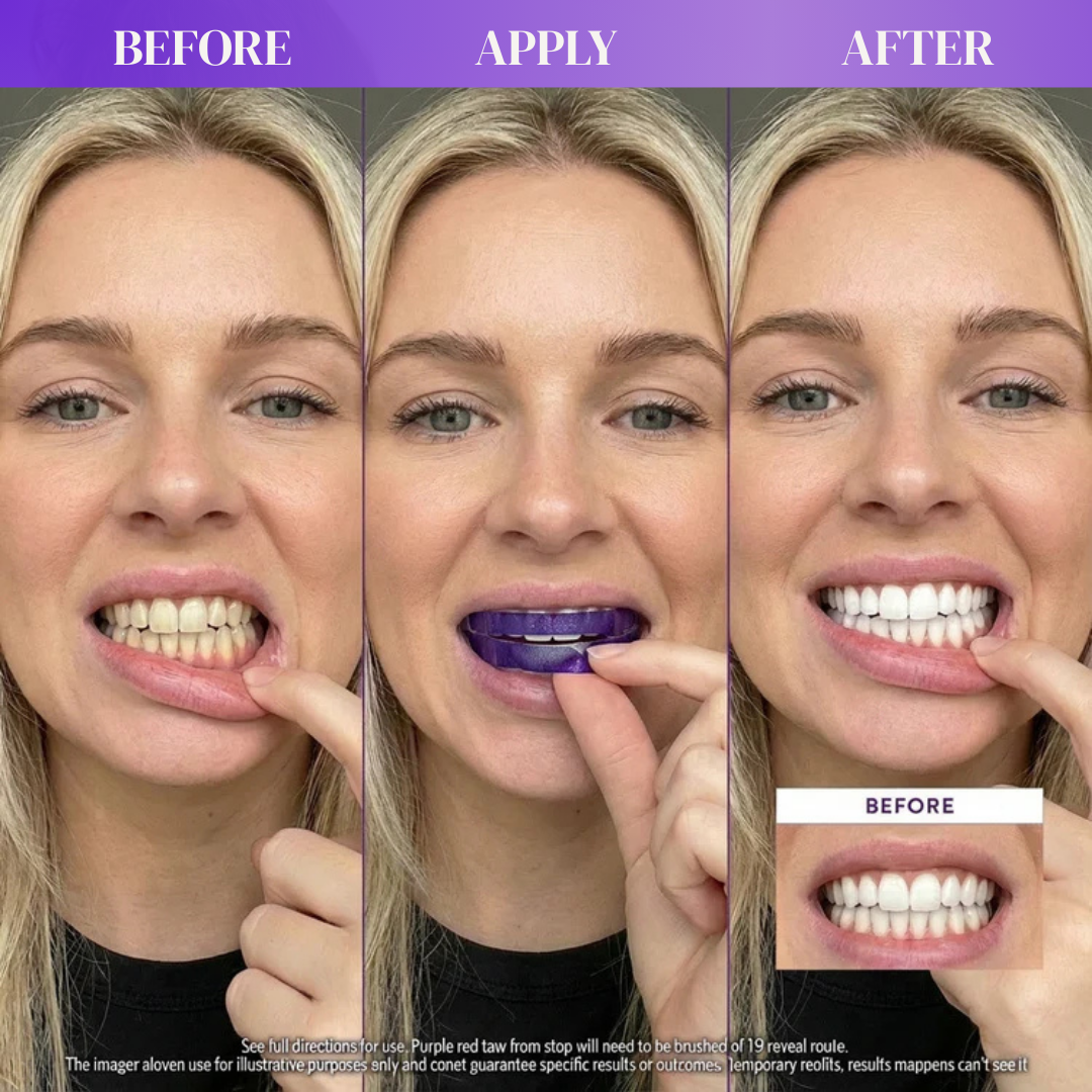 GLOWPURP Purple Strips